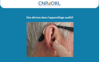 Le CNP d’ORL réagit : « Non les audioprothésistes ne sont pas “mobiles” ! »