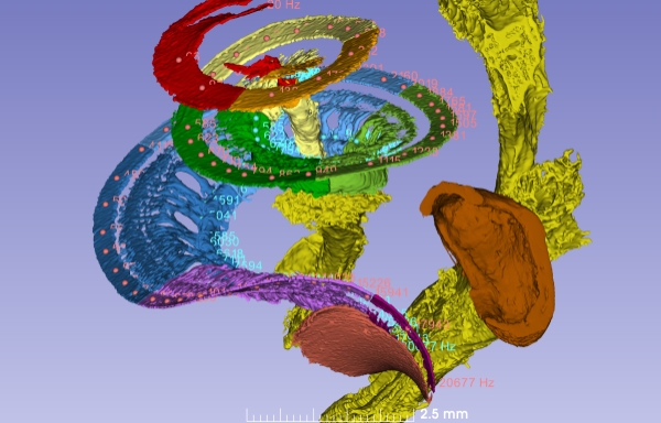 Des chercheurs créent une 1ère carte 3D des zones d’encodage des fréquences sonores par la cochlée