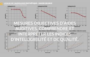 Classe I / classe II, Xavier Delerce explore les conditions d’un comparatif sérieux