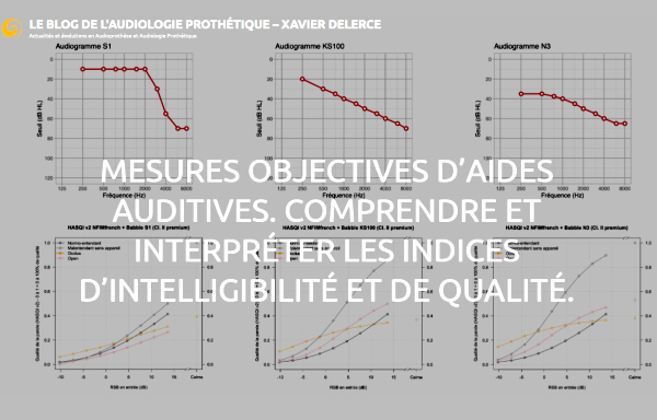 Classe I / classe II, Xavier Delerce explore les conditions d’un comparatif sérieux