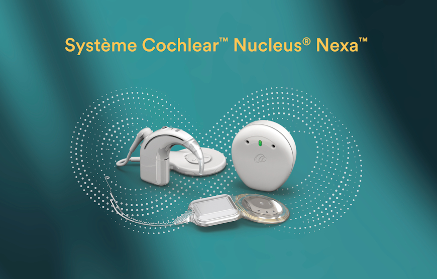Inscription sur la LPP du nouveau système d’implants cochléaires Nucleus Nexa de Cochlear