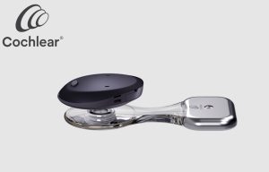 Les implants Osia 2 de Cochlear en passe d’être remboursés