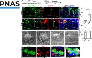 Régénérer les cellules ciliées des mammifères : du mythe à la réalité