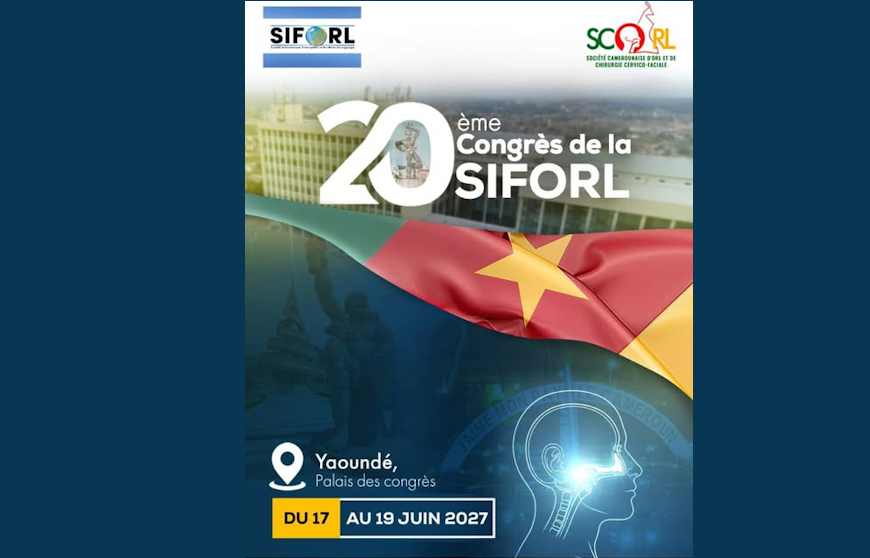 SIFORL