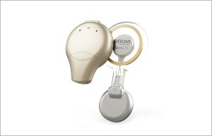 Sentio, nouveau système transcutané d’Oticon Medical, approuvé aux Etats-Unis