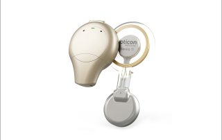 Sentio, nouveau système transcutané d’Oticon Medical, approuvé aux Etats-Unis