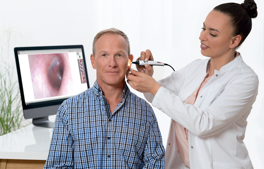 Le vidéo‑otoscope MedRx VO désormais en HD