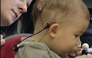 Deux implants cochléaires donnent de meilleurs résultats chez l’enfant